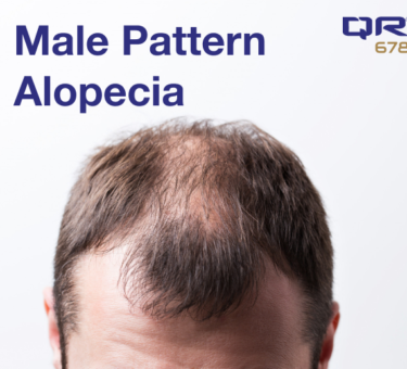 Male Pattern Alopecia