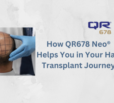 QR678 Neo® Helps in Hair Transplant Journey