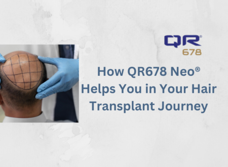 QR678 Neo® Helps in Hair Transplant Journey