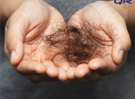 Causes of Hair Thinning in Male & Female