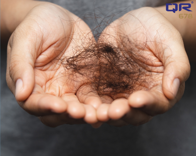 Causes of Hair Thinning in Male & Female