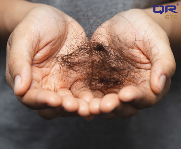 Hair Thinning Causes In Female And Male