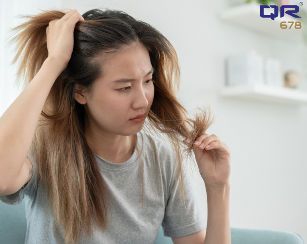 Hormonal Imbalance Hair Loss