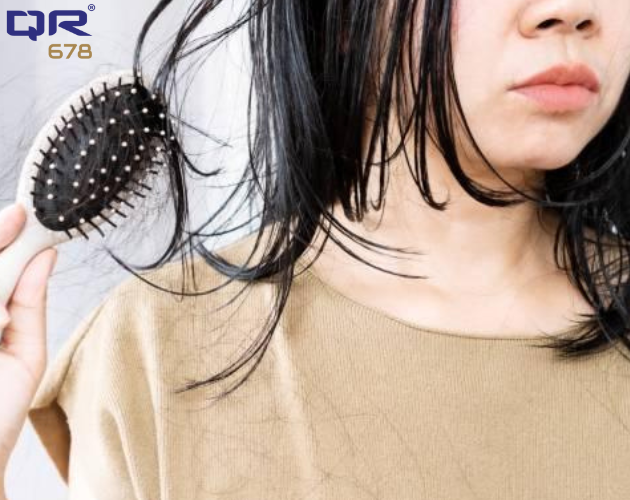 PCOS Cause Hair Loss