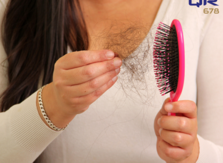 Prevent Hair Fall for Female