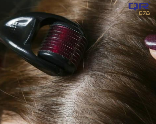 Role of Derma Roller in Reducing Hair Loss