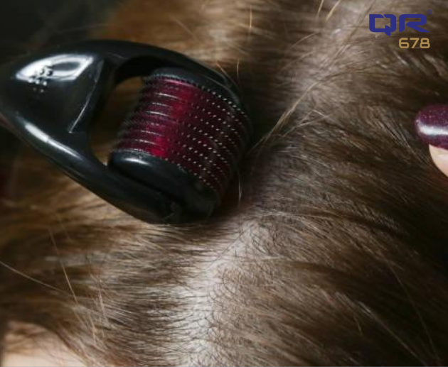 Role of Derma Roller in Reducing Hair Loss: A Complete Guide