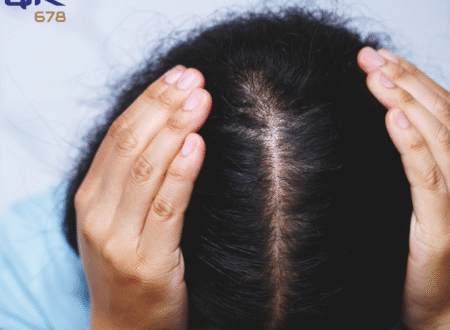 How to Get Rid of Dandruff Fast Best Fixes for Itchy, Flaky Scalp
