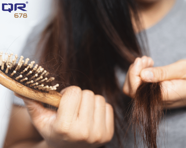 How to Manage Hair Fall Due to Typhoid
